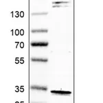 Merck Anti-SIRT5 antibody produced in rabbit