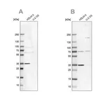 Merck Anti-TTC19 antibody produced in rabbit