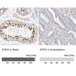 Merck Anti-STK31 antibody produced in rabbit