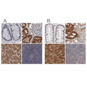Merck Anti-PNPO antibody produced in rabbit