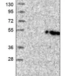 Merck Anti-GLT8D2 antibody produced in rabbit