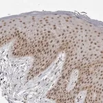 Merck Anti-PRDM10 antibody produced in rabbit