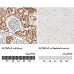 Merck Anti-ALDH7A1 antibody produced in rabbit