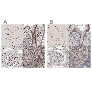 Merck Anti-RBM6 antibody produced in rabbit