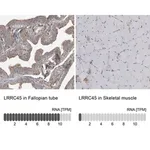 Merck Anti-LRRC45 antibody produced in rabbit