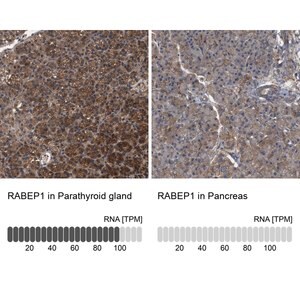 Merck Anti-RABEP1 antibody produced in rabbit
