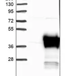 Merck Anti-AKR1A1 antibody produced in rabbit