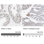 Merck Anti-THOC1 antibody produced in rabbit