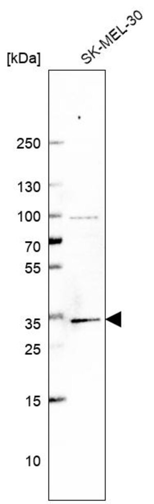 Merck Anti-BRMS1 antibody produced in rabbit