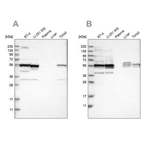 Merck Anti-SMU1 antibody produced in rabbit