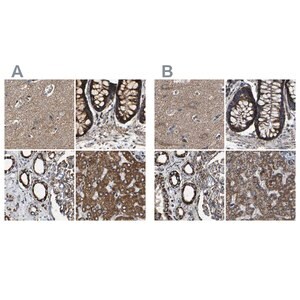 Merck Anti-NDUFV3 antibody produced in rabbit
