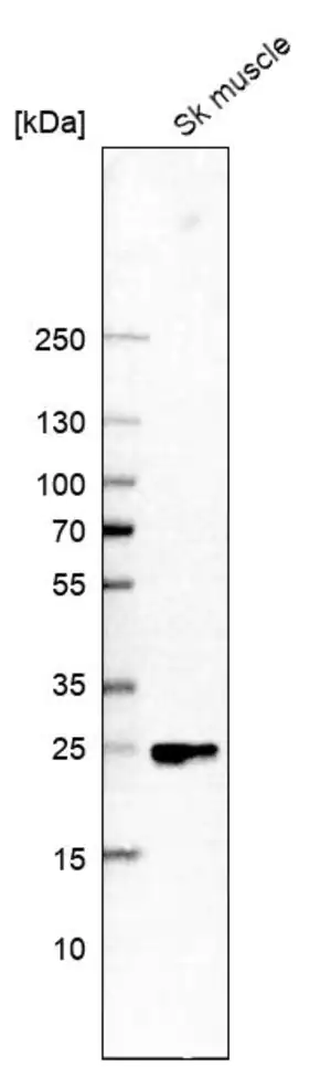 Merck Anti-FITM1 antibody produced in rabbit