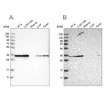 Merck Anti-PPA1 antibody produced in rabbit