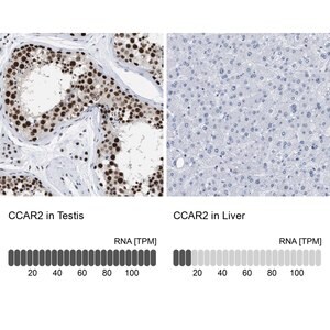 Merck Anti-CCAR2 antibody produced in rabbit