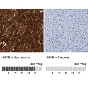 Merck Anti-SGCB antibody produced in rabbit