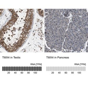 Merck Anti-TMX4 antibody produced in rabbit