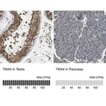 Merck Anti-TMX4 antibody produced in rabbit