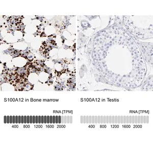 Merck Anti-S100A12 antibody produced in rabbit