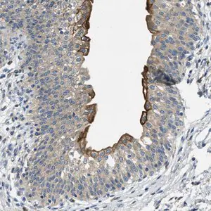 Merck Anti-RIPK2 antibody produced in rabbit
