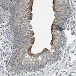 Merck Anti-RIPK2 antibody produced in rabbit