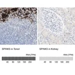 Merck Anti-SPINK5 antibody produced in rabbit