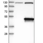Merck Anti-DHPS antibody produced in rabbit