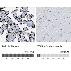 Merck Anti-TOP1 antibody produced in rabbit