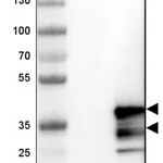 Merck Anti-CHMP3 antibody produced in rabbit