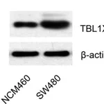 Merck Anti-TBL1XR1 antibody produced in rabbit
