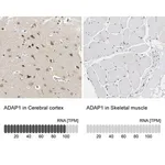 Merck Anti-ADAP1 antibody produced in rabbit