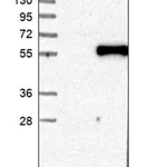 Merck Anti-MUTYH antibody produced in rabbit