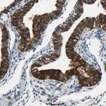 Merck Anti-SLC27A6 antibody produced in rabbit