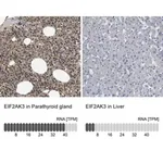 Merck Anti-EIF2AK3 antibody produced in rabbit