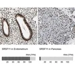 Merck Anti-SRSF11 antibody produced in rabbit