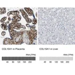 Merck Anti-COL15A1 antibody produced in rabbit
