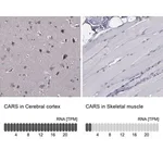 Merck Anti-CARS antibody produced in rabbit