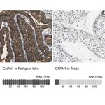 Merck Anti-CAPN1 antibody produced in rabbit