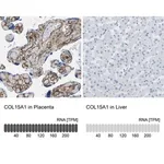 Merck Anti-COL15A1 antibody produced in rabbit
