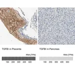 Merck Anti-TGFBI antibody produced in rabbit
