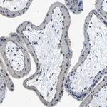 Merck Anti-THSD1 antibody produced in rabbit