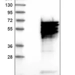 Merck Anti-CACNB4 antibody produced in rabbit
