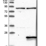 Merck Anti-WRB antibody produced in rabbit
