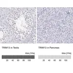Merck Anti-TRIM13 antibody produced in rabbit