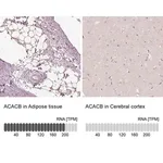Merck Anti-ACACB antibody produced in rabbit