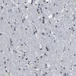 Merck Anti-SNX10 antibody produced in rabbit