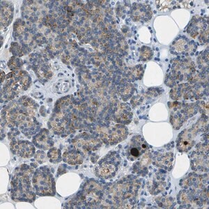 Merck Anti-LGI2 antibody produced in rabbit