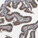 Merck Anti-KAT5 antibody produced in rabbit