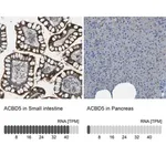 Merck Anti-ACBD5 antibody produced in rabbit