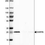 Merck Anti-SNRPB antibody produced in rabbit