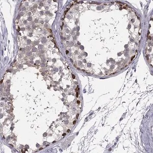 Merck Anti-RSPH14 antibody produced in rabbit